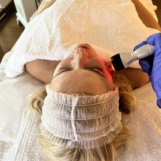 Velvet #beograd Tretman lica Raditalasni lifting - lice