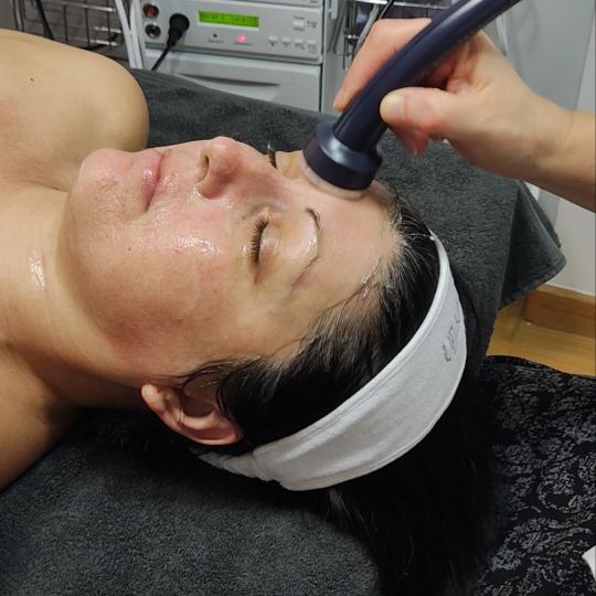 Amelini beauty concept #beograd Tretman lica Bio lift facial biološki tretman