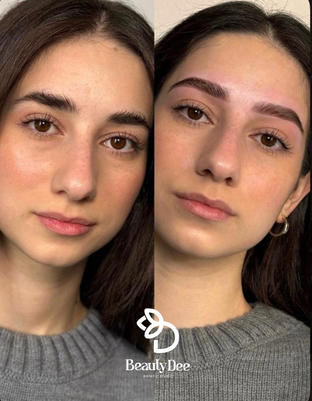 Brow lift - Beauty Dee, Beograd Obrve Lice Obrve, Beograd, Mirijevo