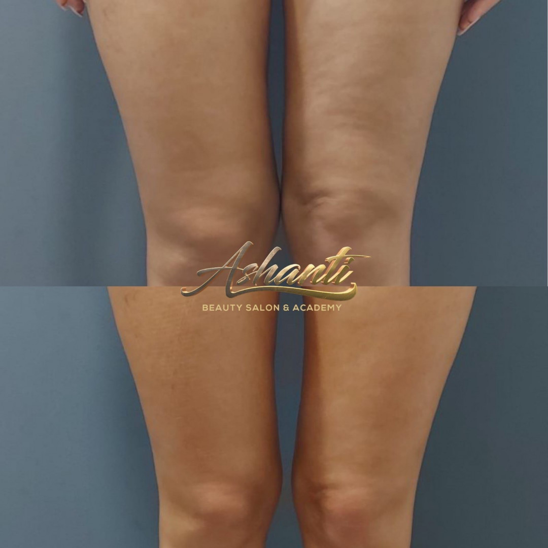Ashanti Beauty Salon & Academy #beograd Masaža za mršavljenje