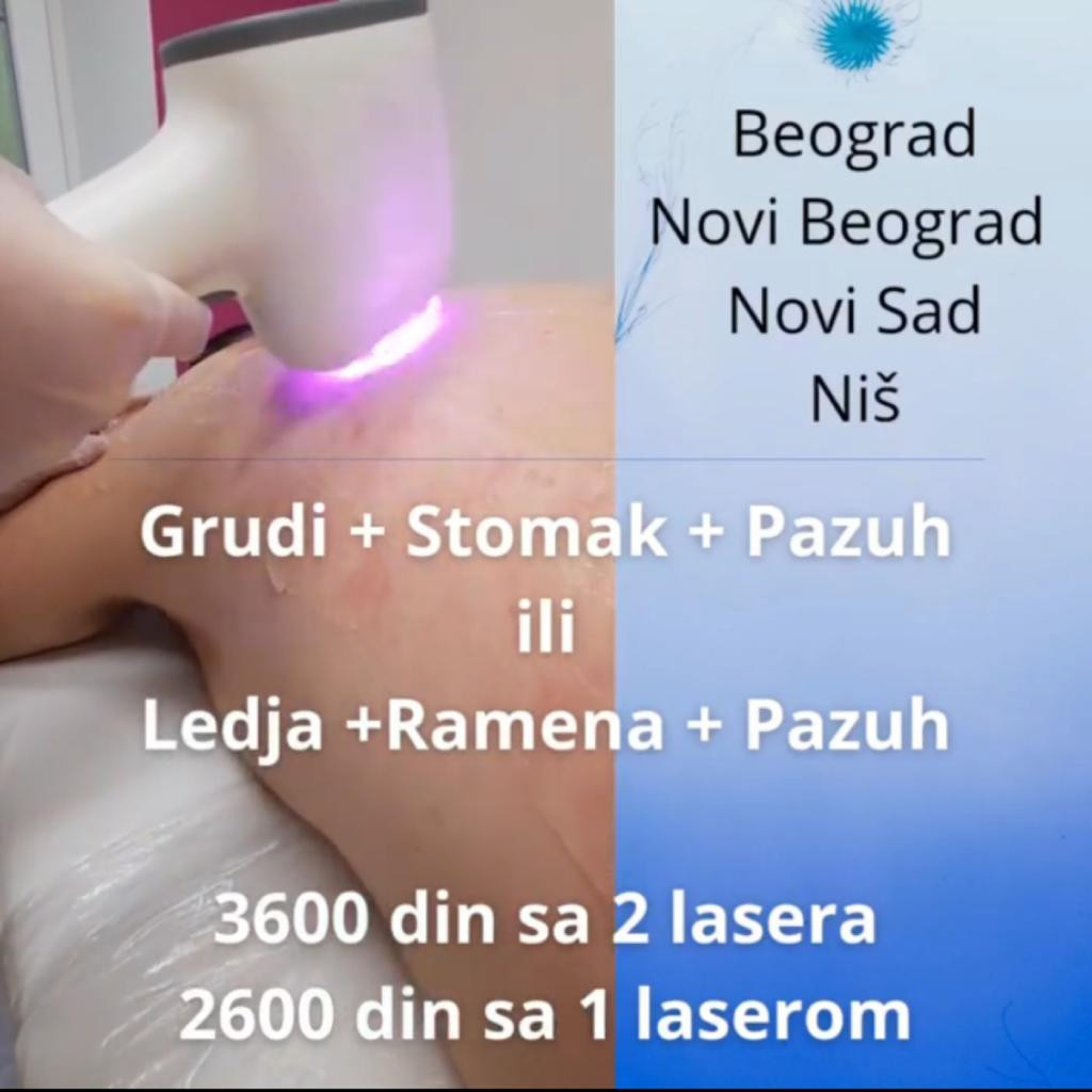 Laser centar Triniti Beograd #beograd Laserska epilacija Epilacija cela leđa + ramena - 2 lasera