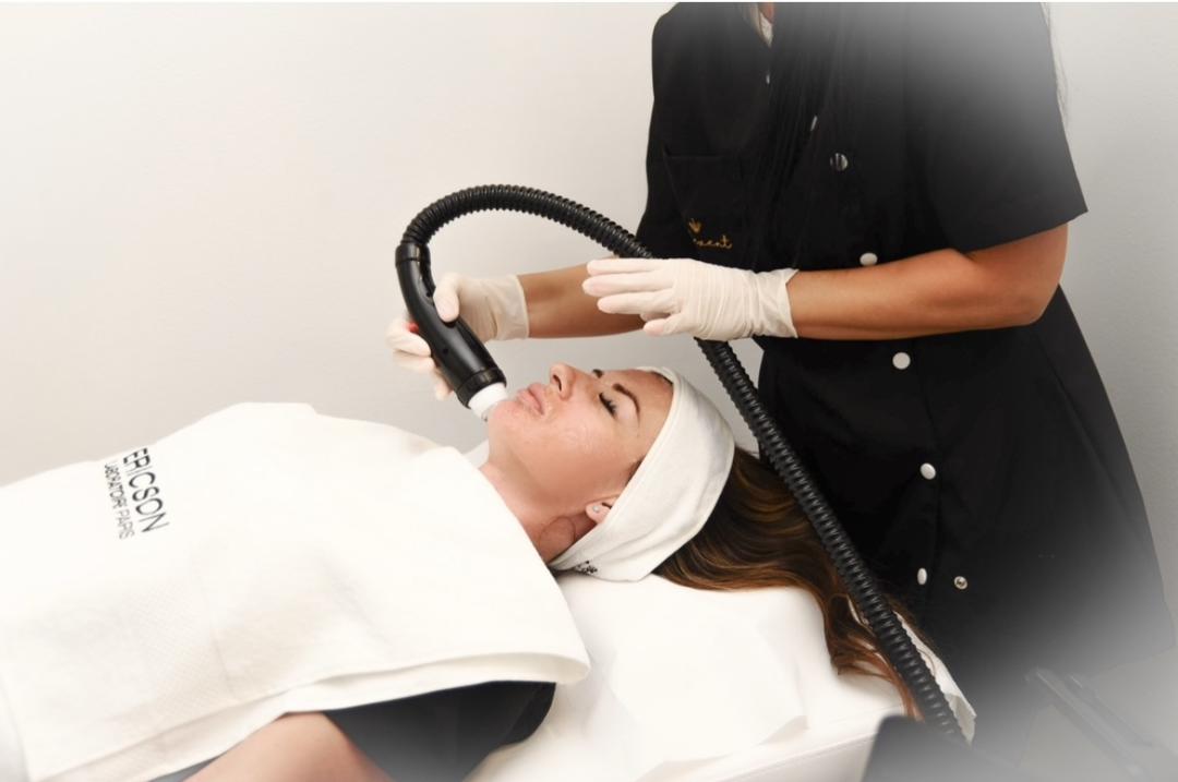 Elevent #beograd Radiotalasni i ultrazvučni tretmani Raditalasni lifting - lice