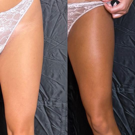 Aura Beauty #beograd Air brush potamnjivanje kože Spray premium tan - celo telo