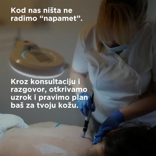 Natural Beauty Lux #beograd Dermaroler i dermapen Detmapen tretman - protiv ožiljaka na telu Dermap