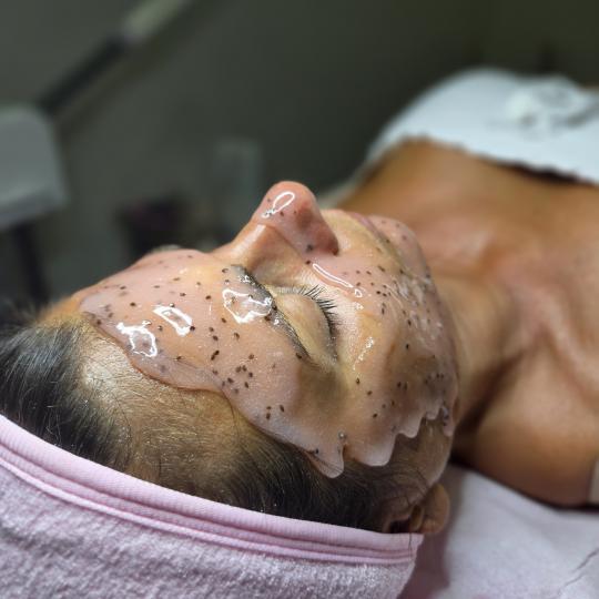 Starmedic #beograd Tretman lica Klasičan tretman lica