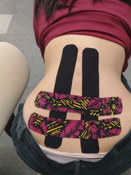 Touch Aesthetic&Medical care #beograd Tretmani tela Kinezio teiping leđa