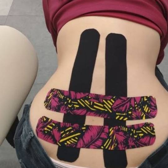 Touch Aesthetic&Medical care #beograd Tretmani tela Kinezio teiping leđa Tretmani tela