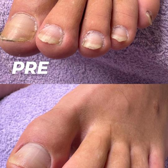 Dals Studio by Anica #novisad Medicinski pedikir Medicinski pedikir - osnovni MUŠKI MEDICINSKI PEDI