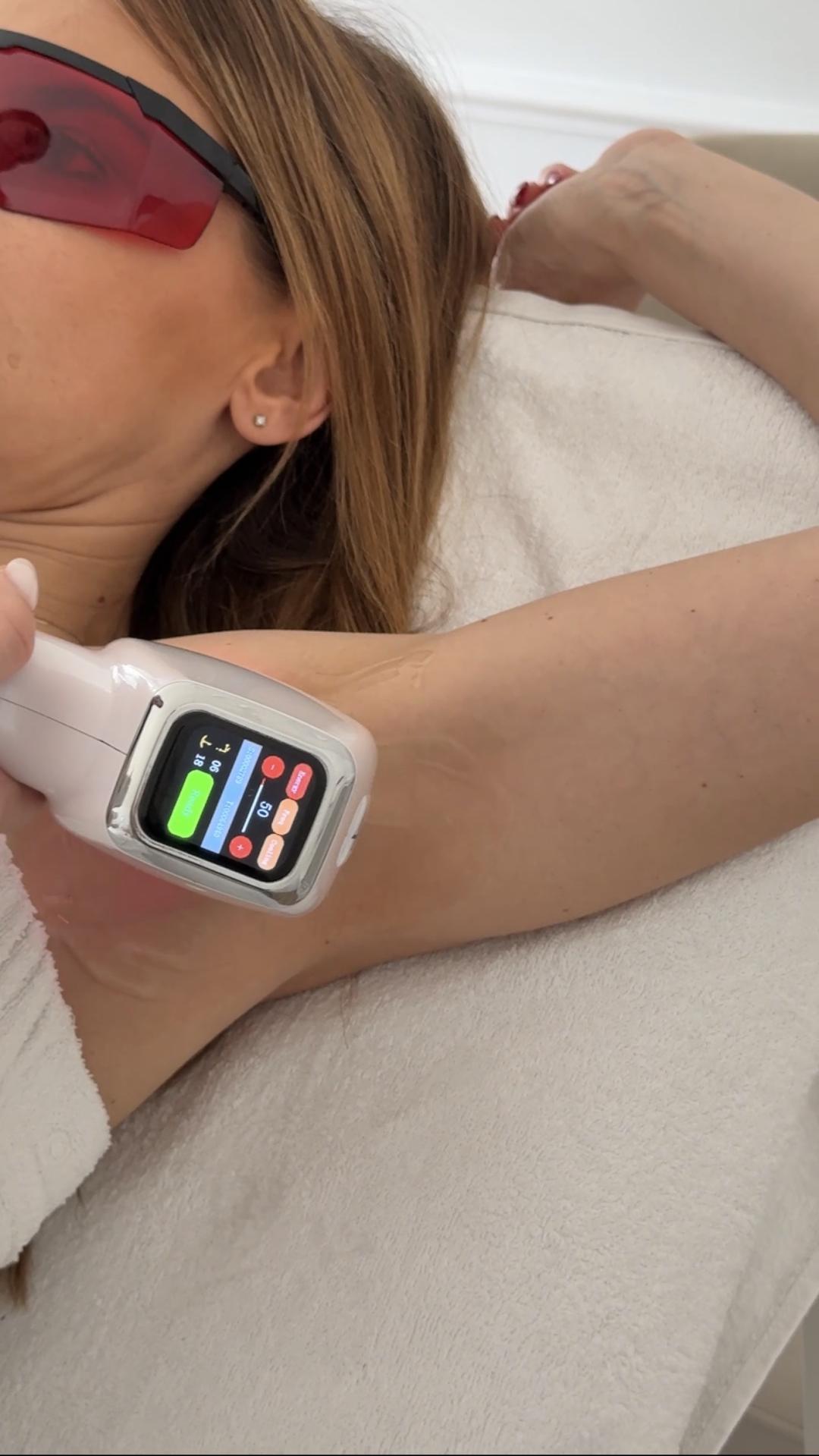 Lola esthetic center #beograd Laserska epilacija Laserska epilacija pazuha - za dame