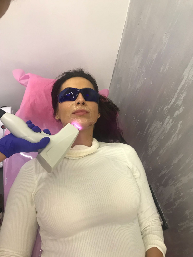 Body Beauty Balance 2020 #beograd Laserska epilacija