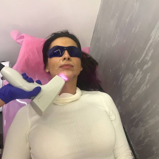 Body Beauty Balance 2020 #beograd Laserska epilacija