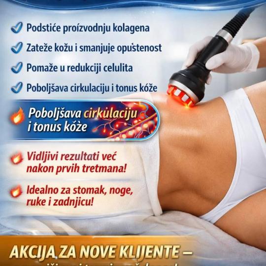 Astradas 2 #beograd Radiotalasni i ultrazvučni tretmani Radiotalasni lifting - gluteus