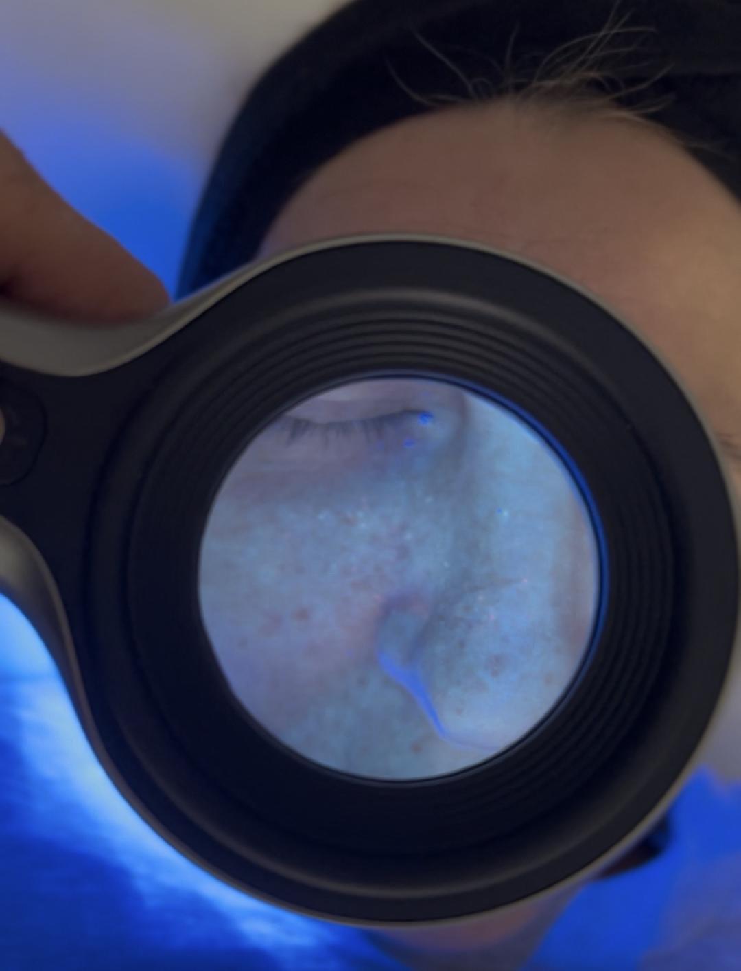 Sandra estetik studio #beograd Tretman lica Higijenski tretman lica