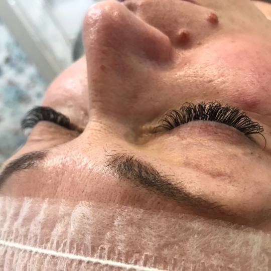 Estetic star by Maya #beograd Nadogradnja trepavica 1na1 Nadogradnja svilenih trepavica - metoda 1 n