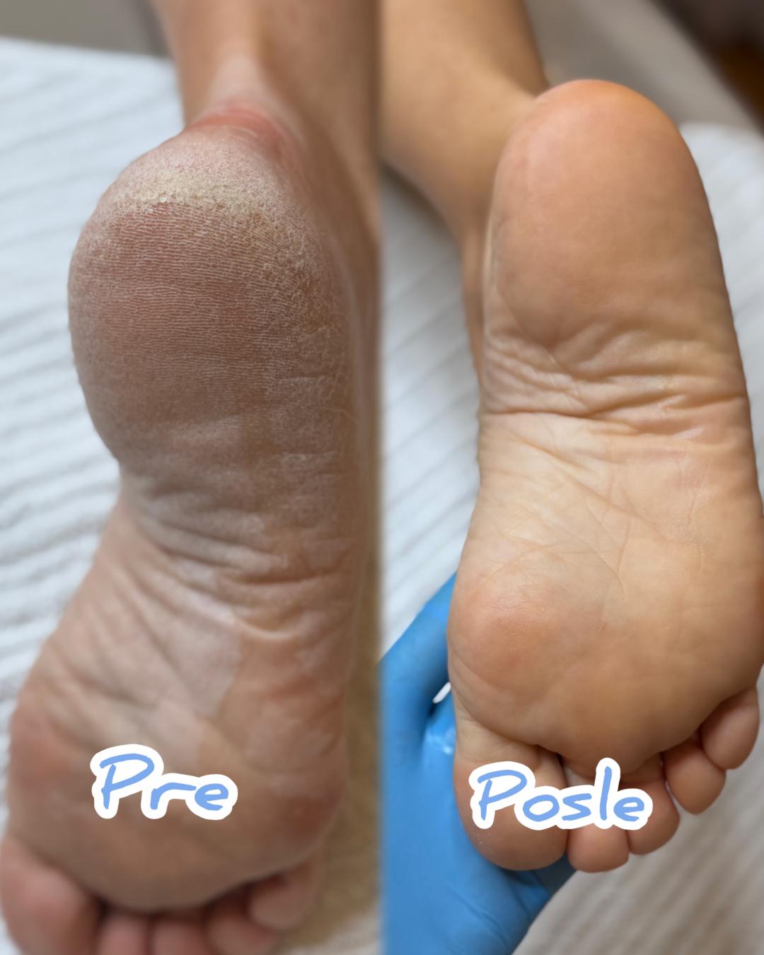 Estetski aparatni pedikir - Beauty Dee, Beograd Estetski pedikir Nokti Estetski pedikir, Beograd, Mirijevo