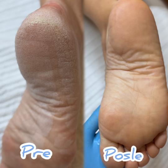 Beauty Dee #beograd Estetski pedikir Estetski aparatni pedikir