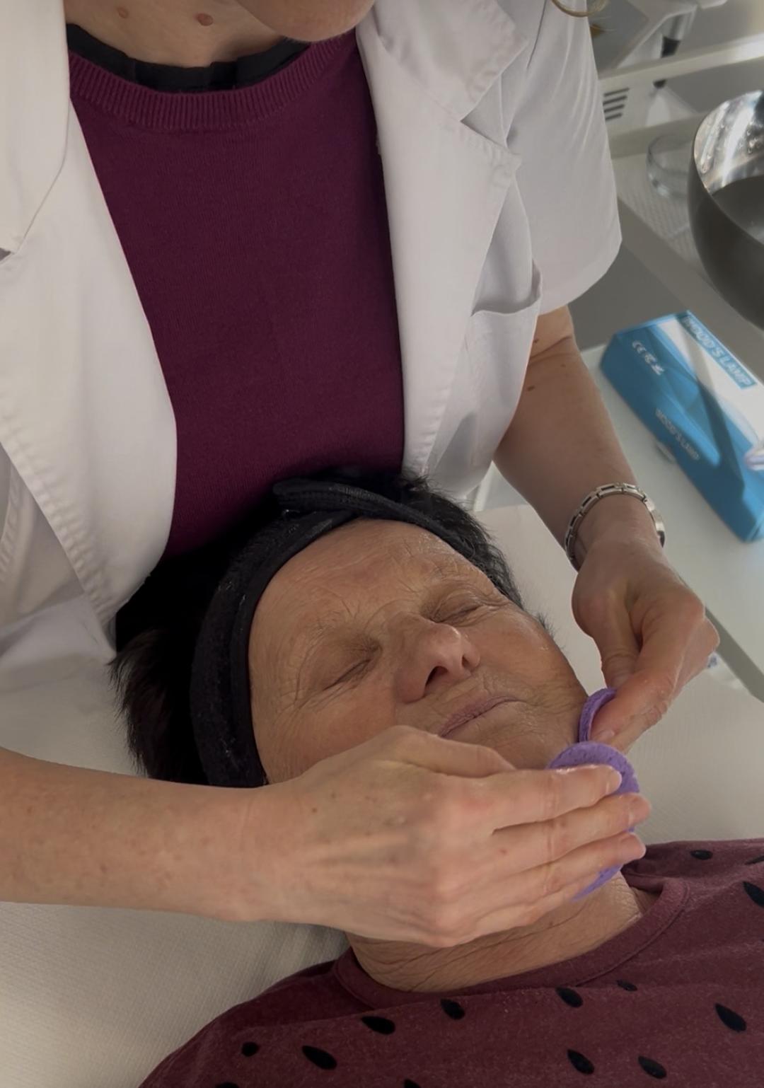 Sandra estetik studio #beograd Tretman lica Mezoporacija lica