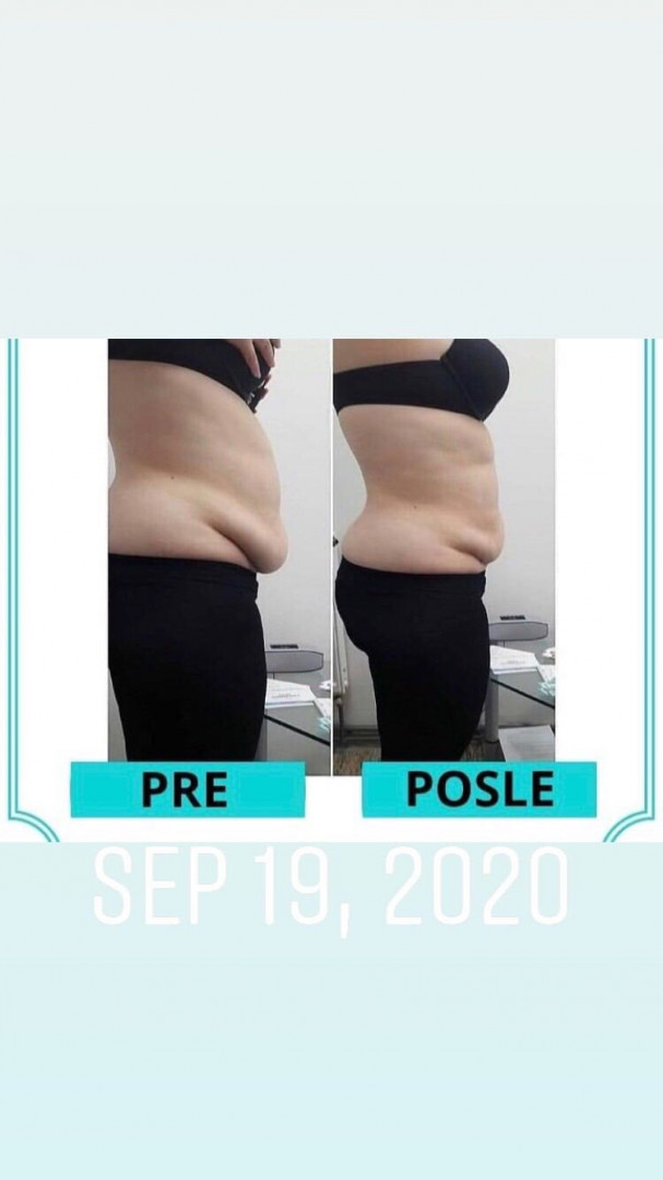 Body Beauty Balance 2020 #beograd Kavitacija