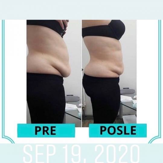 Body Beauty Balance 2020 #beograd Kavitacija