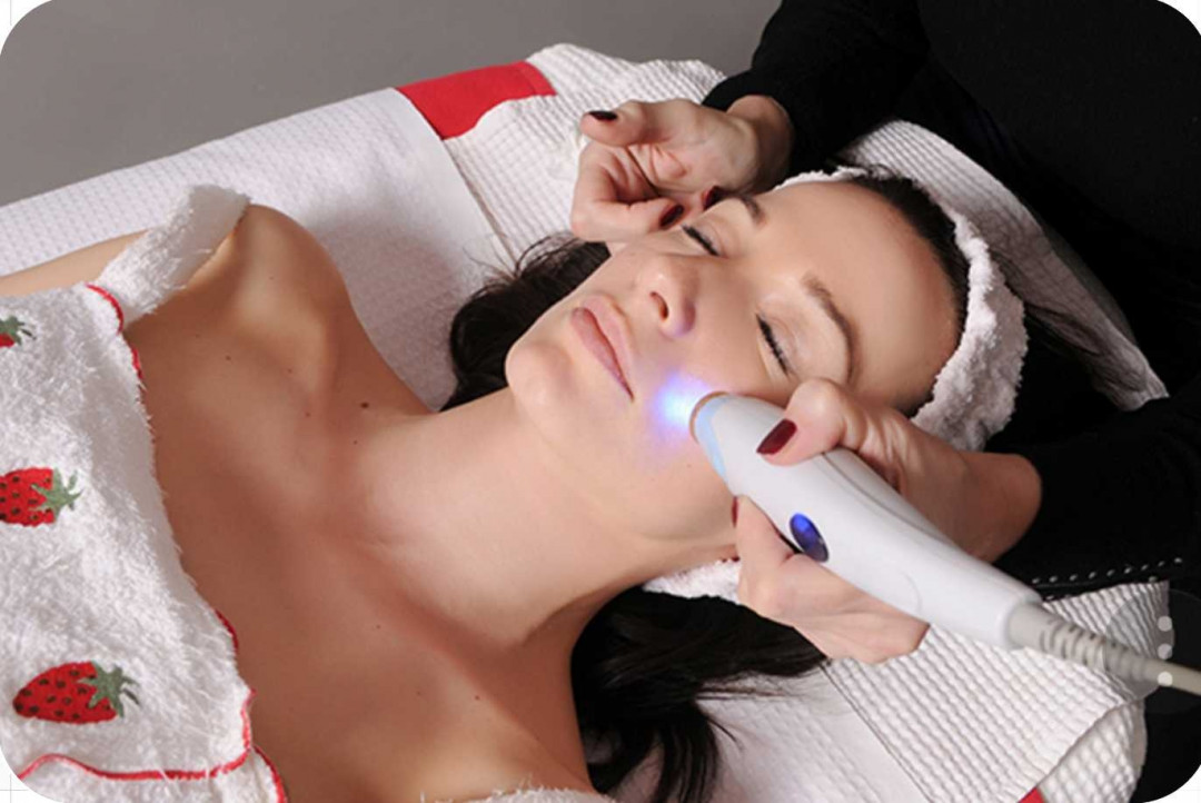 Grossi cosmetic #beograd Lifting / zatezanje kože