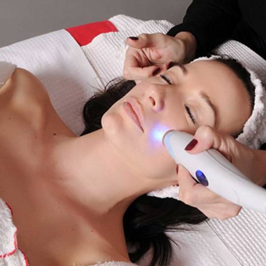 Grossi cosmetic #beograd Lifting / zatezanje kože