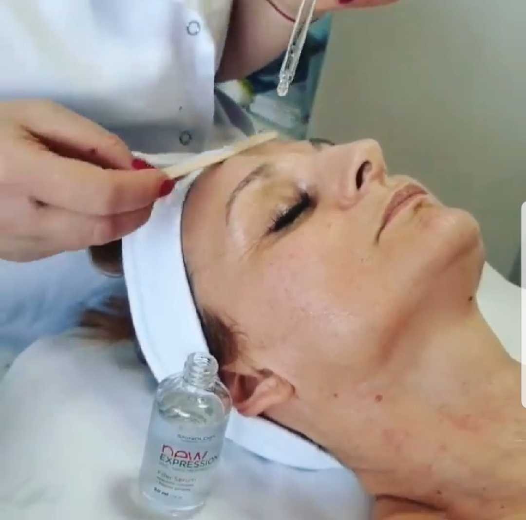 PRP Dermapen - Tina B, Beograd Tretman lica Lice Tretman lica, Beograd, Novi Beograd blokovi, Belville, Savski kej