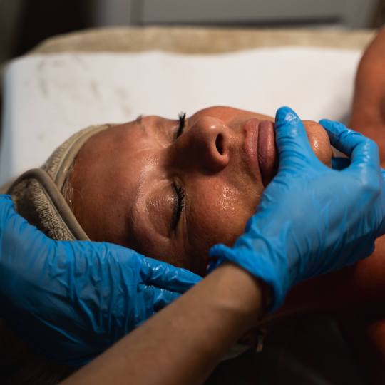 MediBella Aesthetic Dedinje #beograd Tretman lica Lift CVS biološki tretman lica
