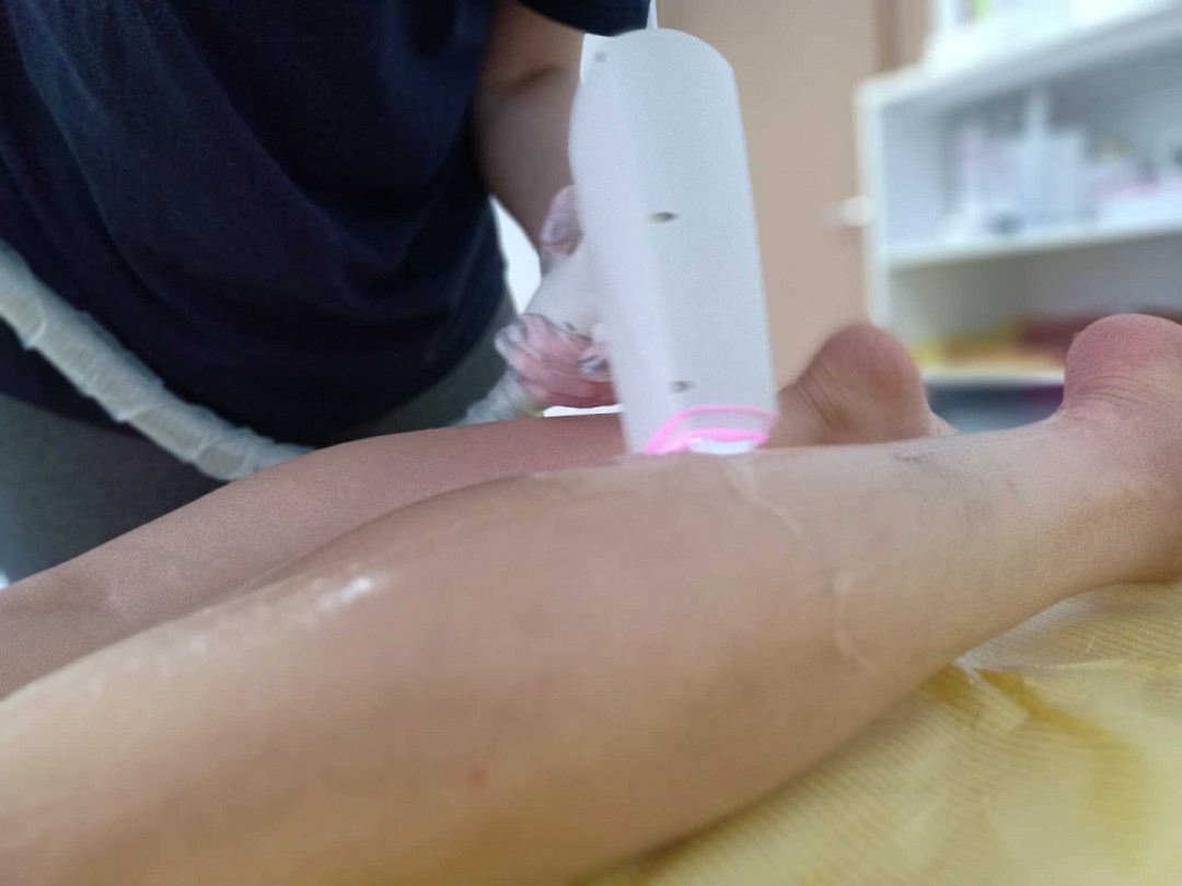 Krasiva #beograd Laserska epilacija Estetski ( klasičan ) pedikir + lakiranje