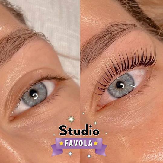 Studio Favola #beograd Trepavice