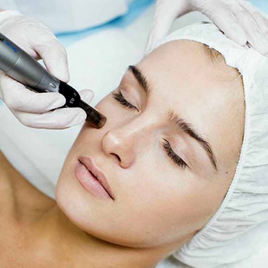 Beauty and me #novisad Tretman lica Mezoterapija (sa dermapenom) - Vitaminska nega (vitamini, matič