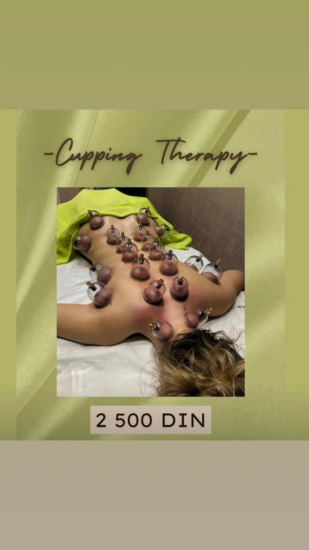Miriam Studio #novisad Tretmani tela Suvi cupping