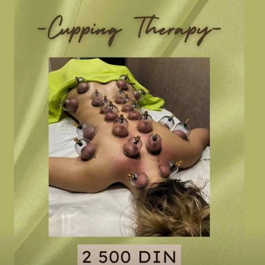 Miriam Studio #novisad Tretmani tela Suvi cupping