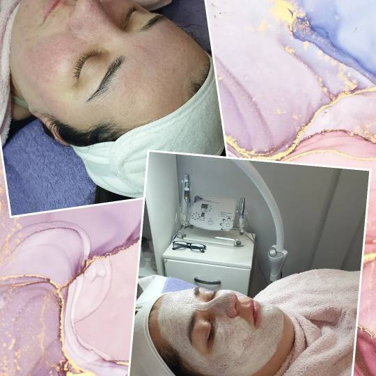 Beauty by Alex #beograd Mezoterapija lica Mezoporacija lica