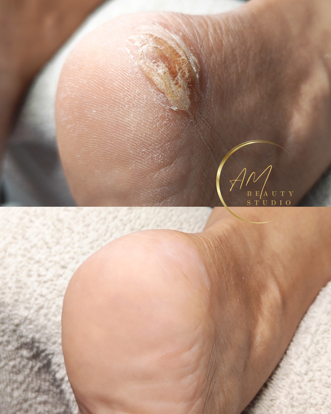 AM BEAUTY STUDIO #odzaci Tretmani tela Aparatni pedikir sa čarapama za hidrataciju