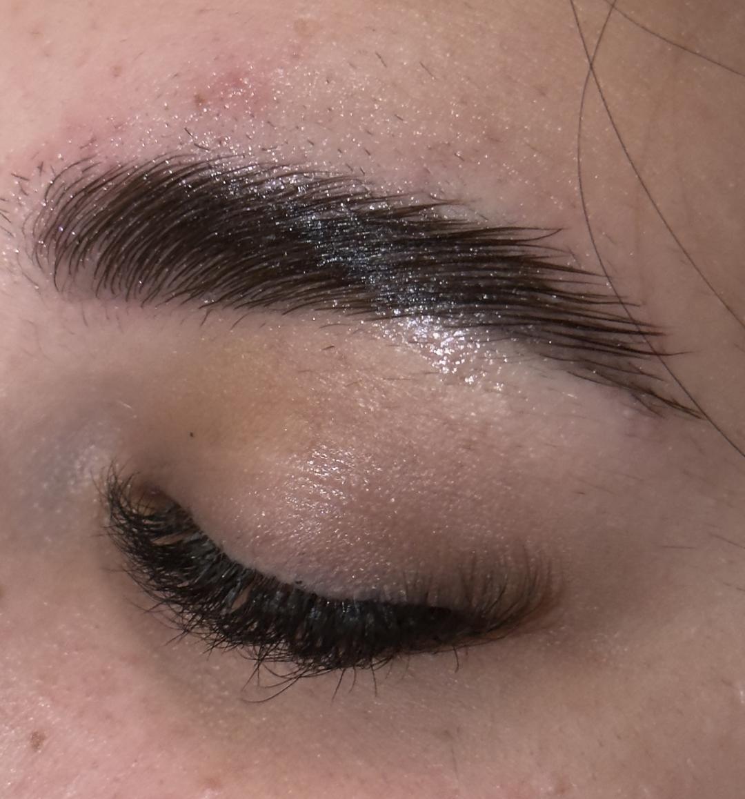 Brow lift - Lola esthetic center, Beograd Obrve Lice Obrve, Beograd, Novi Beograd blokovi, Belville, Savski kej