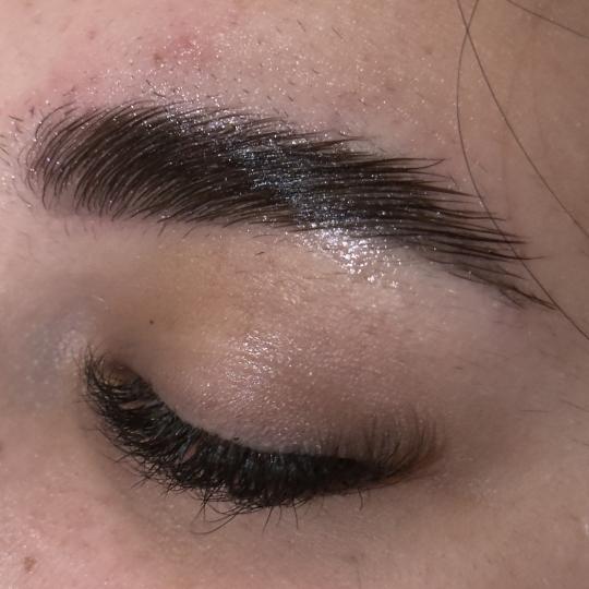 Lola esthetic center #beograd Obrve Brow lift