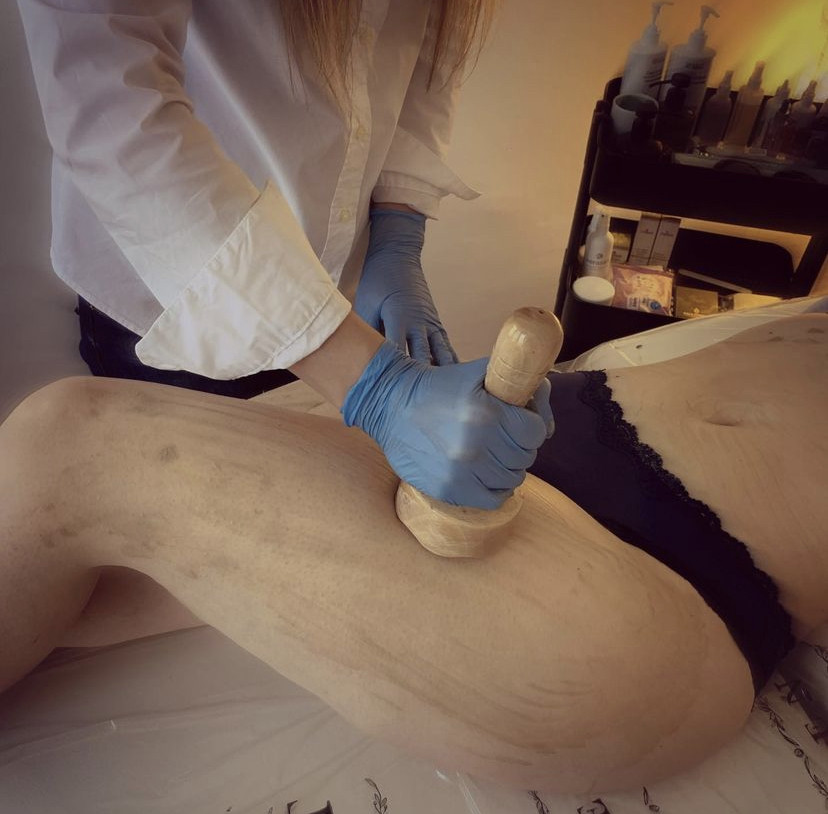 Guardian Beauty Centar & Milica Tepavac #beograd Masaža za mršavljenje Ice body sculpting - noge + gluteus + stomak