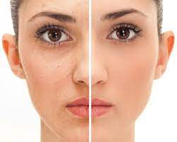 Vila Beauty Studio #beograd Tretman lica BB Glow tretman lica
