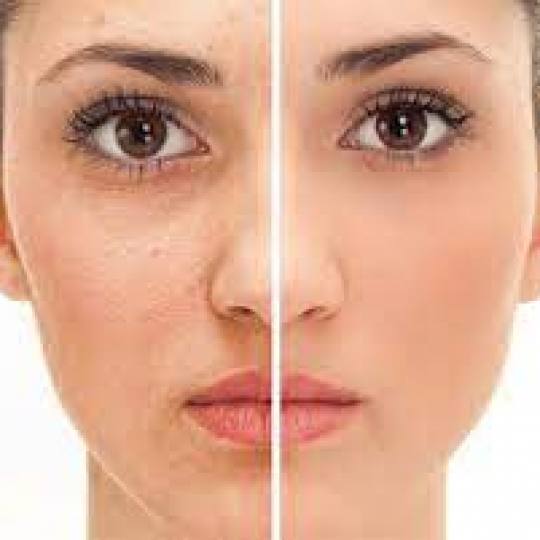 Vila Beauty Studio #beograd Tretman lica BB Glow tretman lica -BB Glow je revolucionarni tretman koj