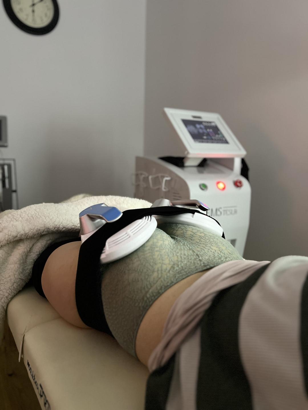 Amelini beauty concept #beograd Tretmani tela EMS tesla