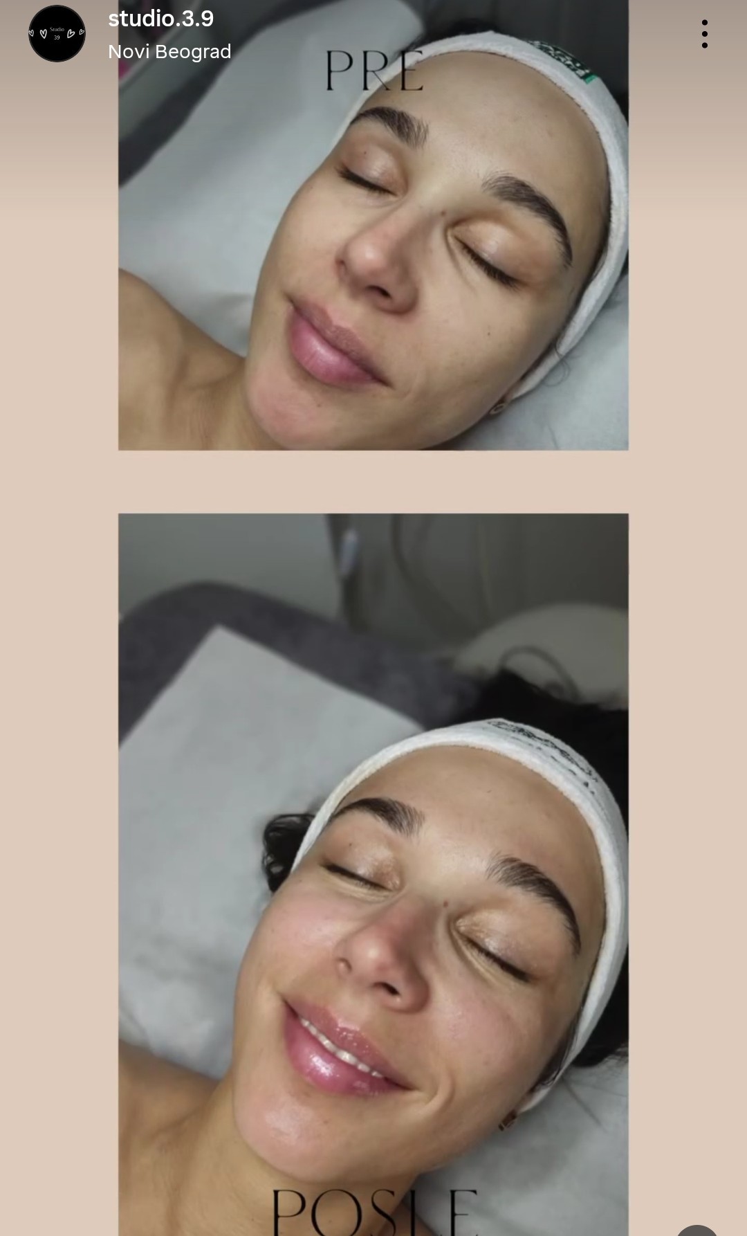 Studio 39 #beograd Masaža lica Masaža lica