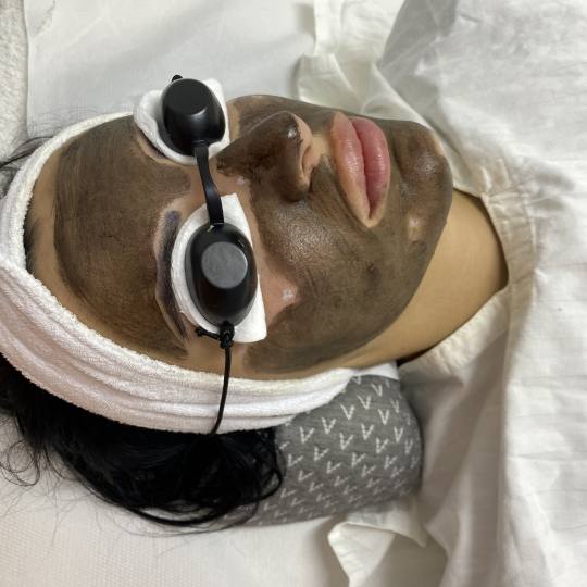 Helios #kikinda Priprema za carbon peel-laser