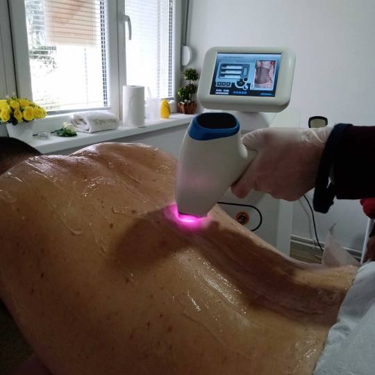 Krasiva 2 #beograd Laserska epilacija Laserska epilacija leđa + ramena - za muškarce