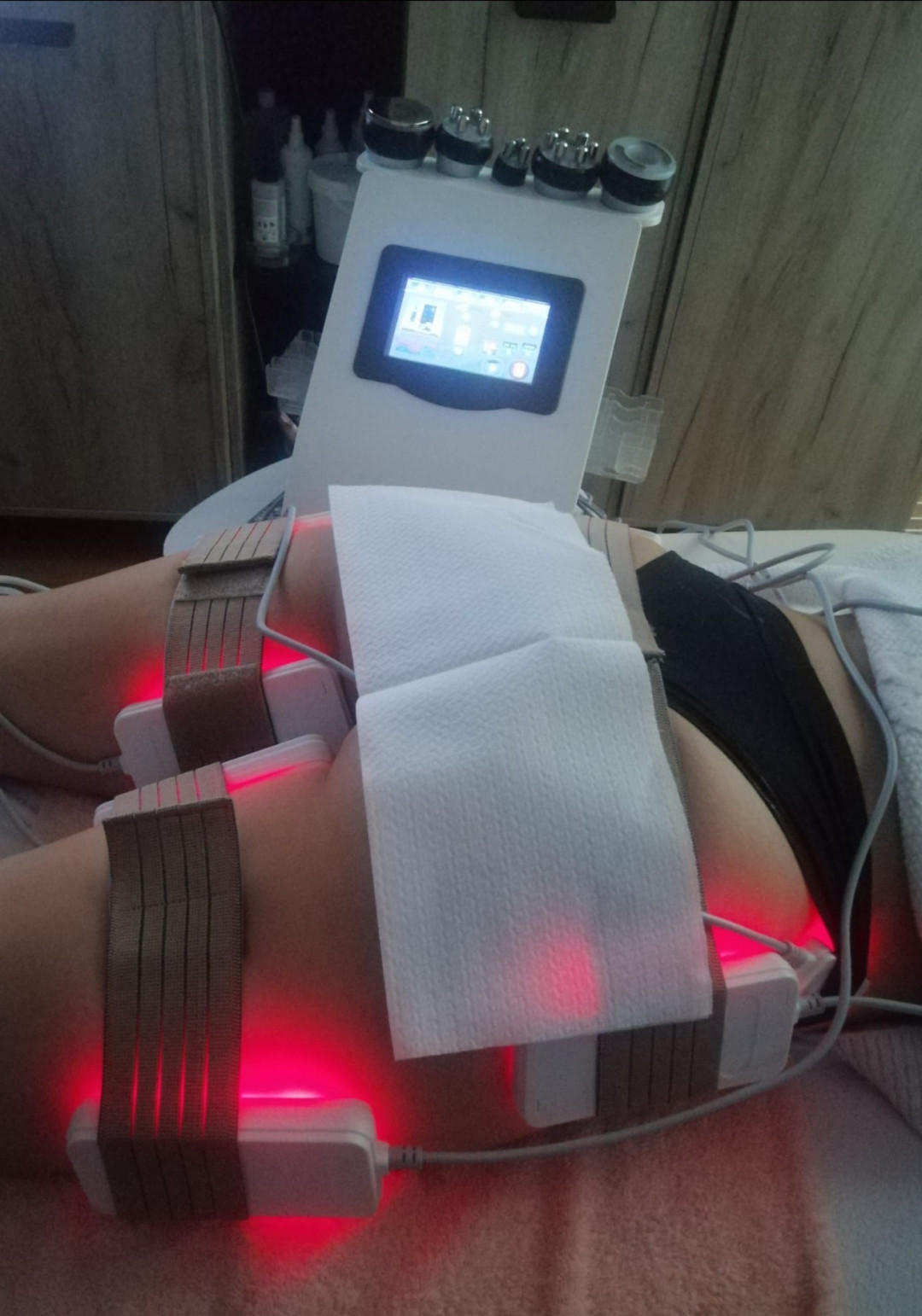 Lipolaser Centar - Matrix021 #novisad Tretmani tela