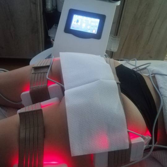 Lipolaser Centar - Matrix021 #novisad Tretmani tela 👉Neinvazivna liposukcija Diodnim laserom, zat