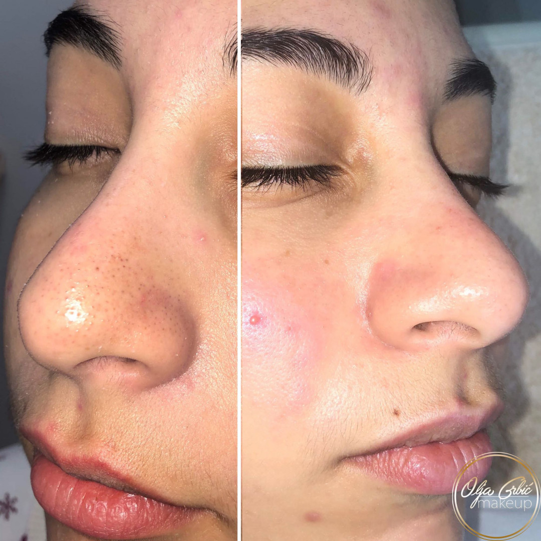 Makeup Olja Grbić #novisad Tretman lica Čišćenje lica ultrazvučnom špatulom