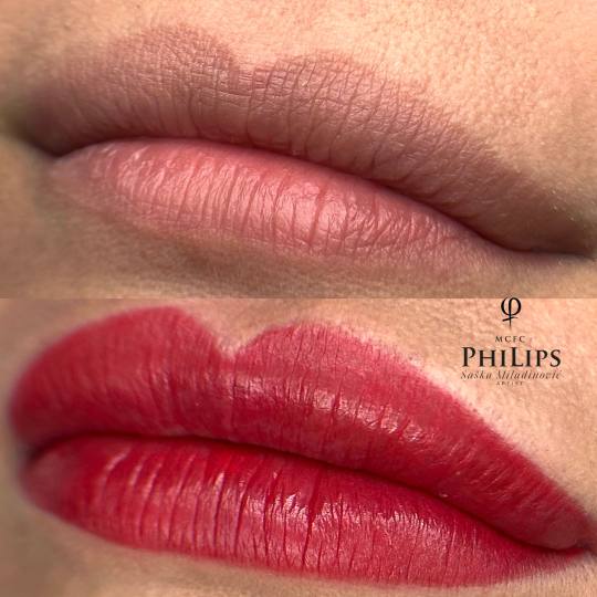 Esthetique Privé #beograd Trajna šminka Trajna šminka usana - PHILIPPS