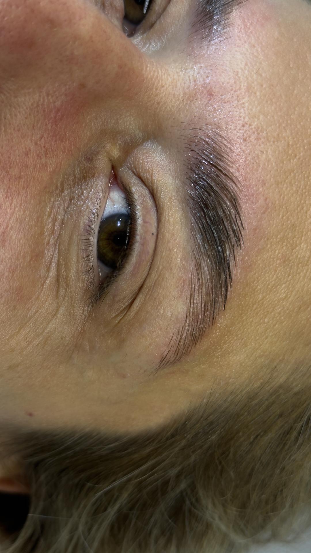 Brow lift - Lola esthetic center, Beograd Obrve Lice Obrve, Beograd, Novi Beograd blokovi, Belville, Savski kej