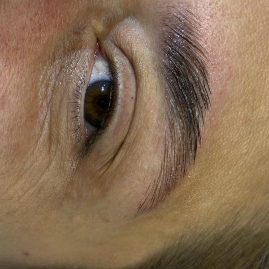 Lola esthetic center usluga