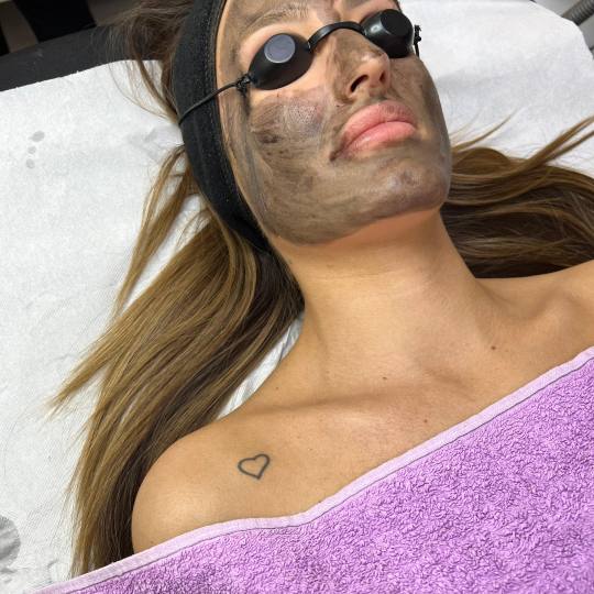 Laser centar Delight #beograd Piling lica Tretman lica karbon pilom Dubinsko ciscenje lica,karbon pa